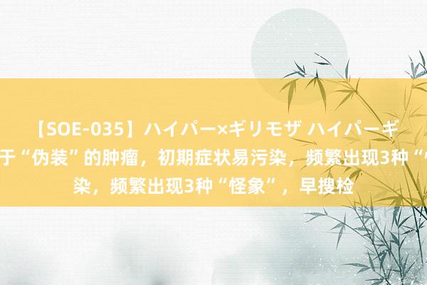 【SOE-035】ハイパー×ギリモザ ハイパーギリモザ Ami 善于“伪装”的肿瘤，初期症状易污染，频繁出现3种“怪象”，早搜检